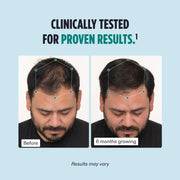 Nutrafol Men Hair Growth Supplement for Thicker