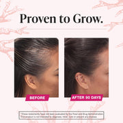 Viviscal Hair Growth Supplements For Women