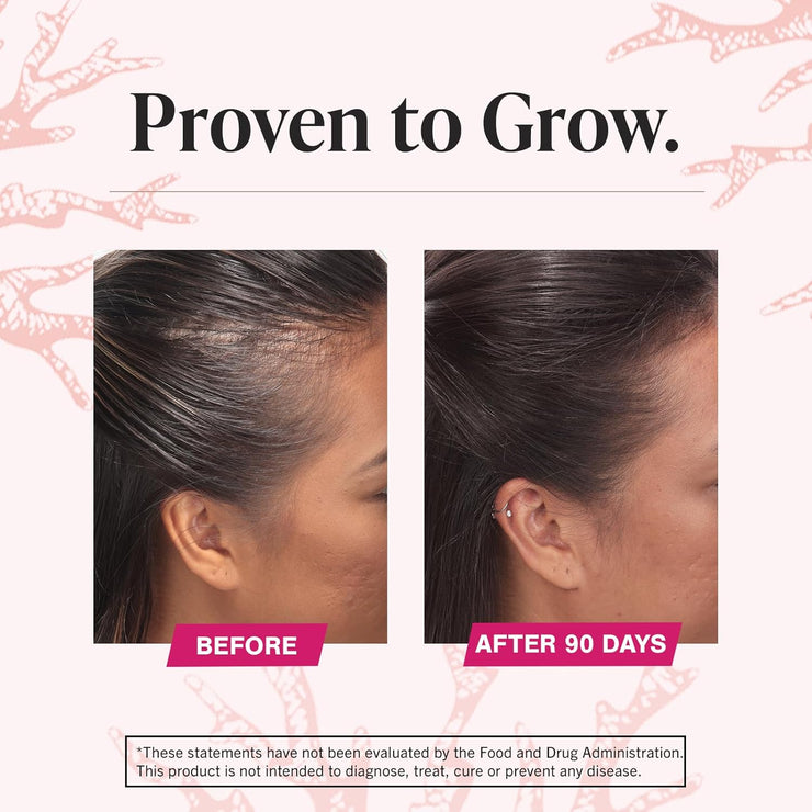 Viviscal Hair Growth Supplements For Women