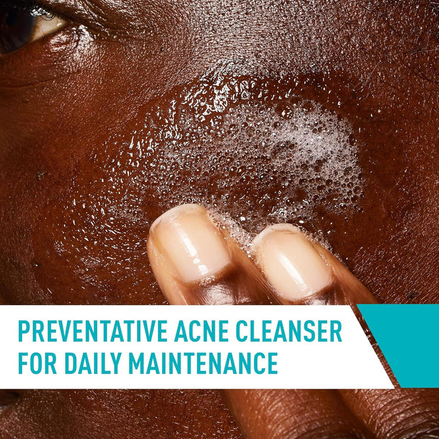 CeraVe Acne Treatment Face Wash, Salicylic Acid Cleanser with Purifying Clay